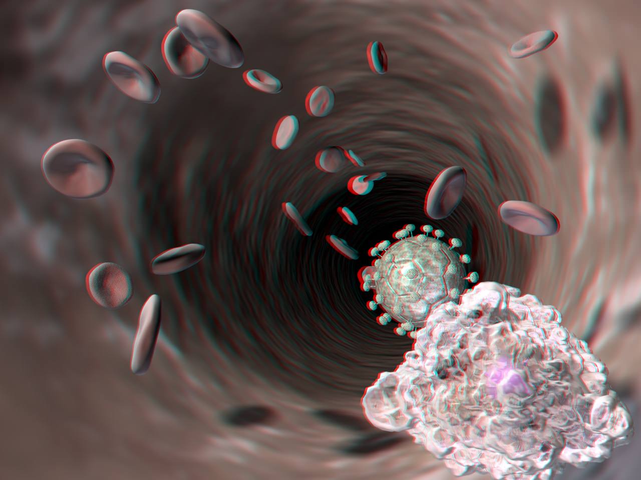 anaglyphe 3D Ansicht HIV Gross